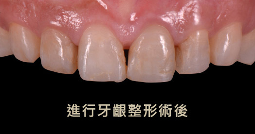 光明牙醫診所張庭豪醫師一頁pic4 4