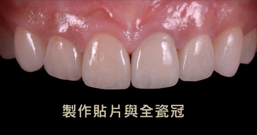 光明牙醫診所張庭豪醫師一頁pic4 5