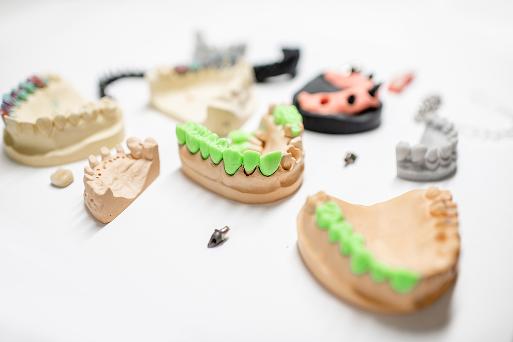 artificial jaw models with dental implants 2021 09 01 14 50 00 utc