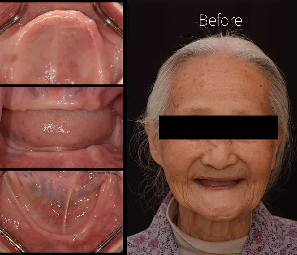 drbrian denture case1 1