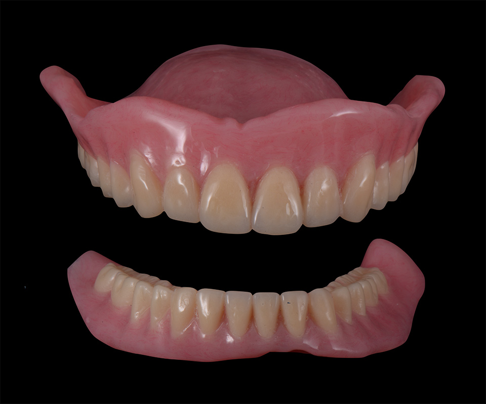 drbrian denture case1 2