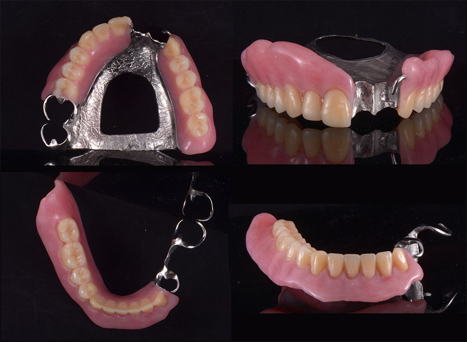 drbrian denture case2 4