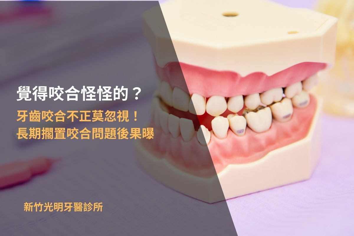 Read more about the article 覺得咬合怪怪的？牙齒咬合不正莫忽視！長期擱置咬合問題後果曝