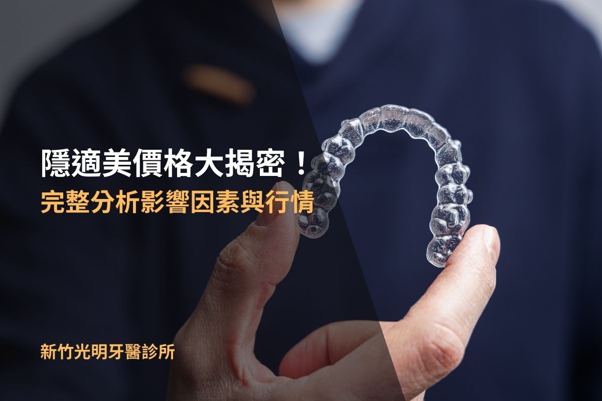 Read more about the article 隱適美價格大揭密！完整分析影響因素與行情