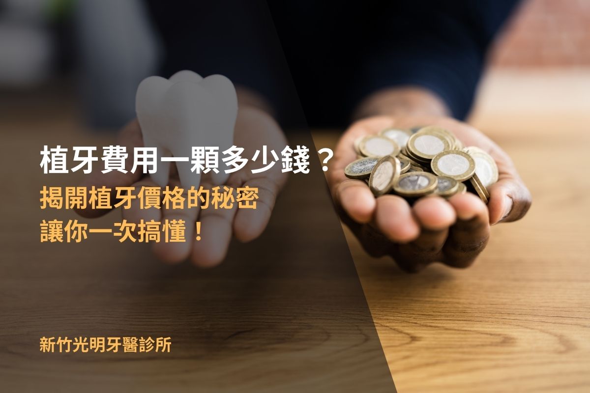 Read more about the article 植牙費用一顆多少錢？揭開植牙價格的秘密，讓你一次搞懂！