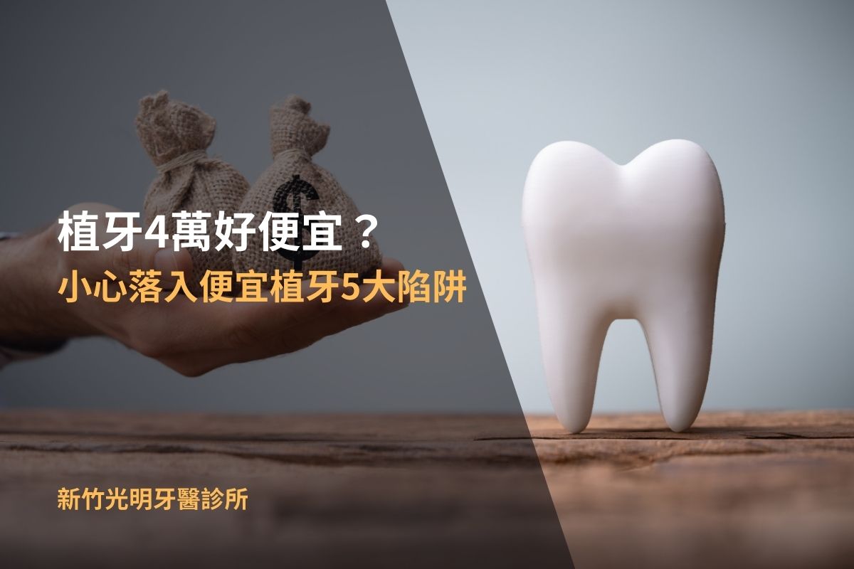 Read more about the article 植牙4萬好便宜？小心落入便宜植牙5大陷阱！
