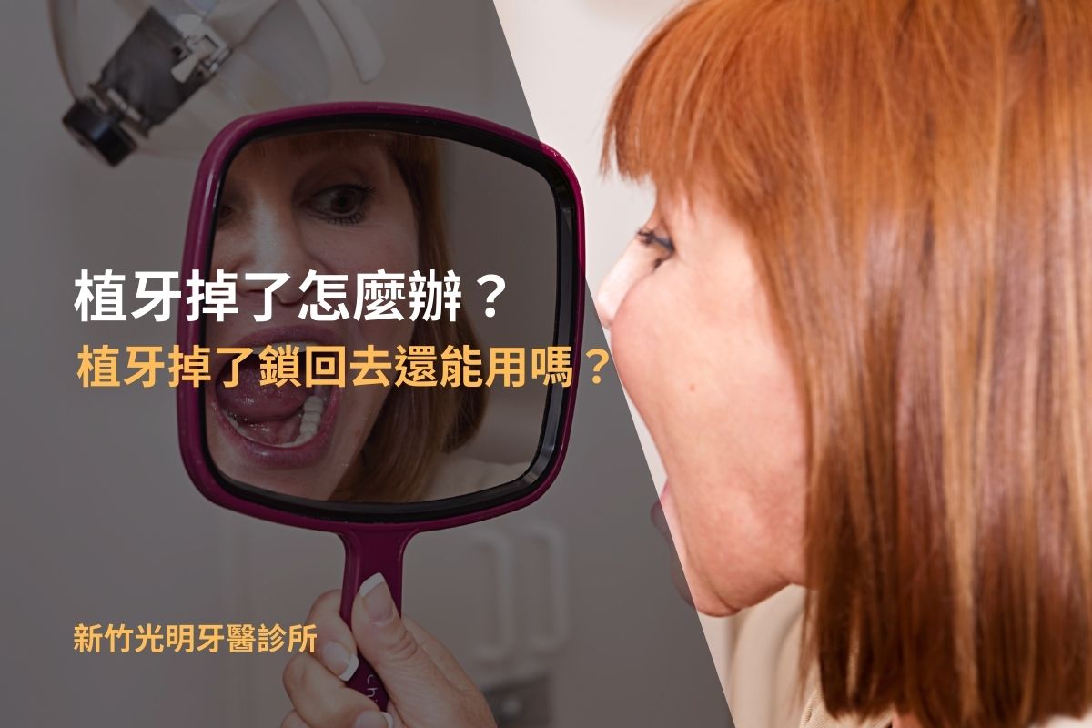 Read more about the article 植牙掉了怎麼辦？植牙掉了鎖回去還能用嗎？