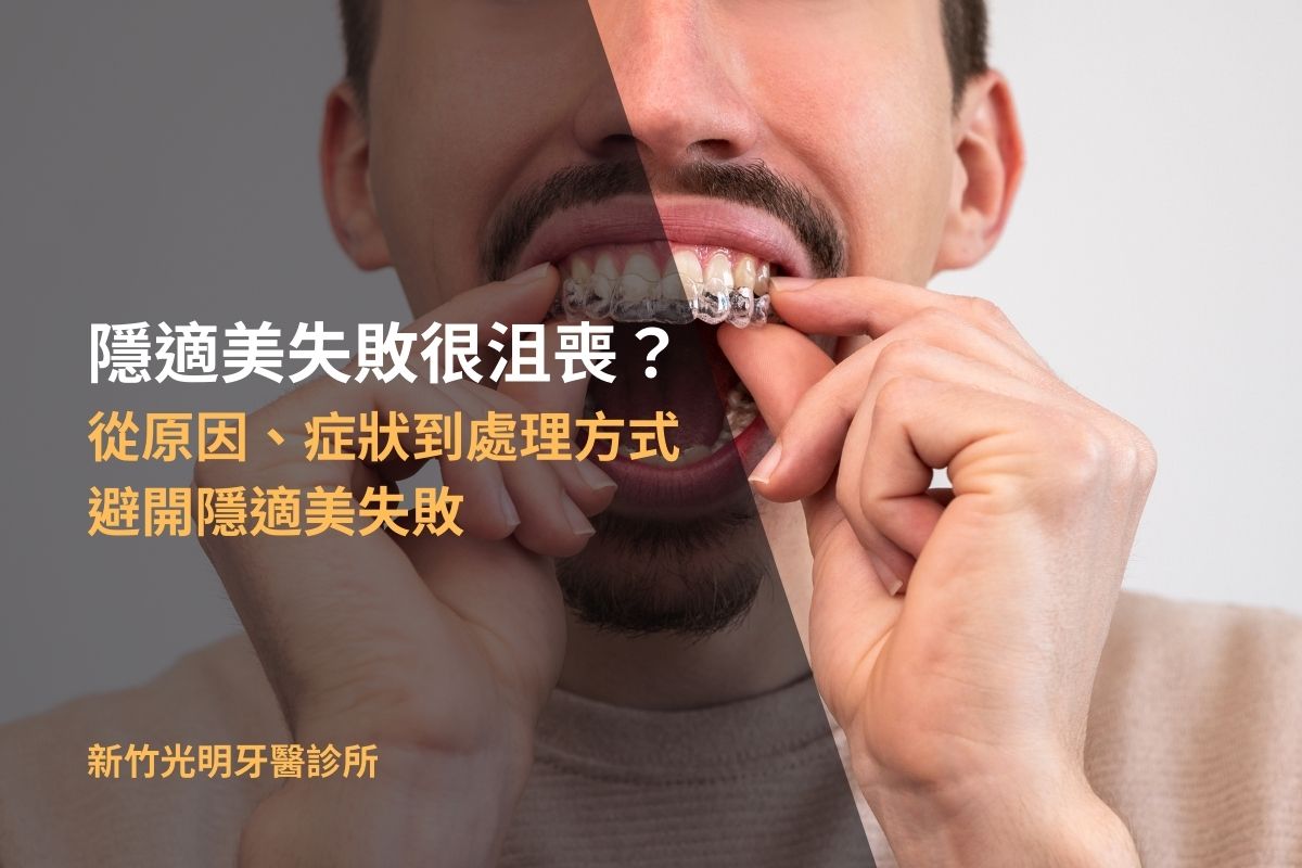 Read more about the article 隱適美失敗很沮喪？從原因、症狀到處理方式，避開隱適美失敗