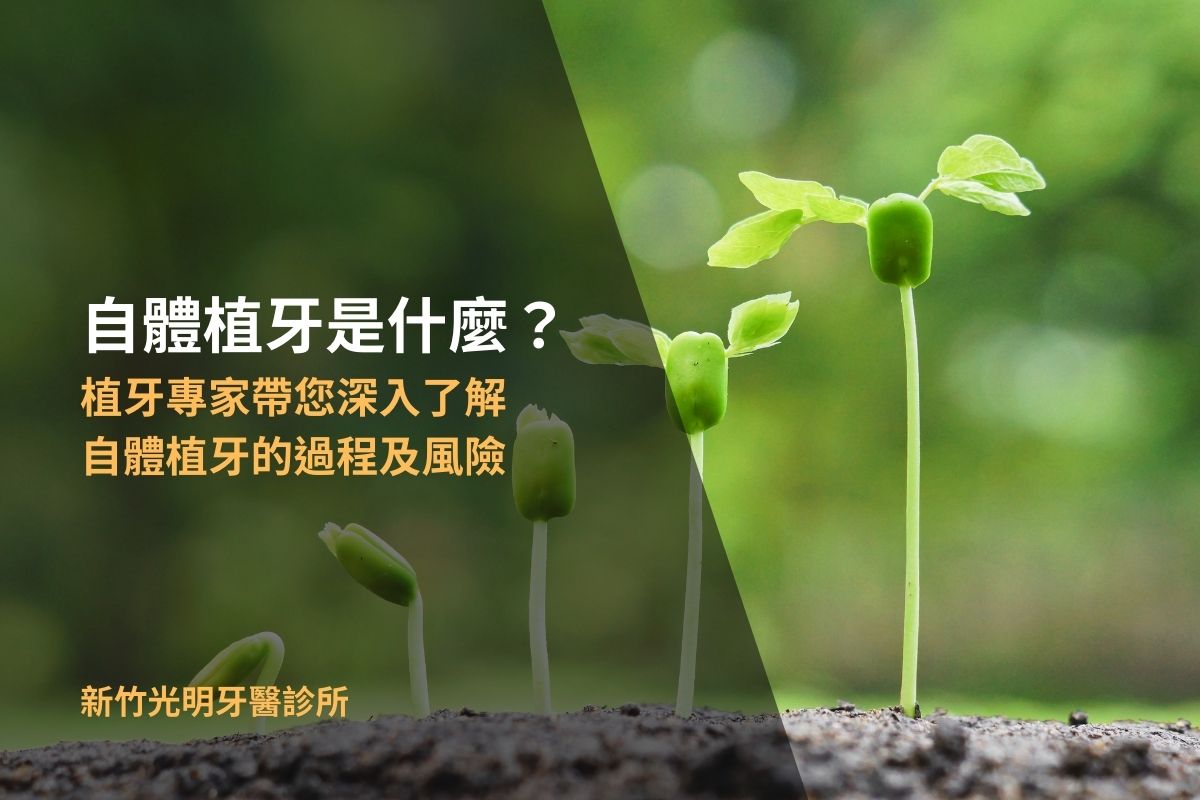 Read more about the article 自體植牙是什麼？植牙專家帶您深入了解自體植牙的過程及風險