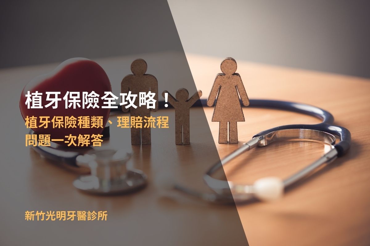 Read more about the article 植牙保險全攻略！植牙保險種類、理賠流程等問題一次解答
