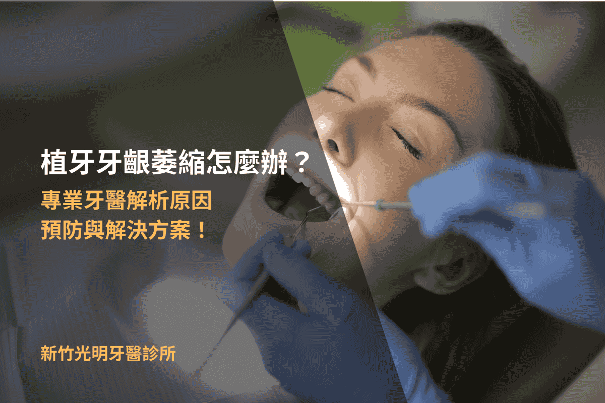 Read more about the article 植牙牙齦萎縮怎麼辦？專業牙醫解析原因、預防與解決方案！