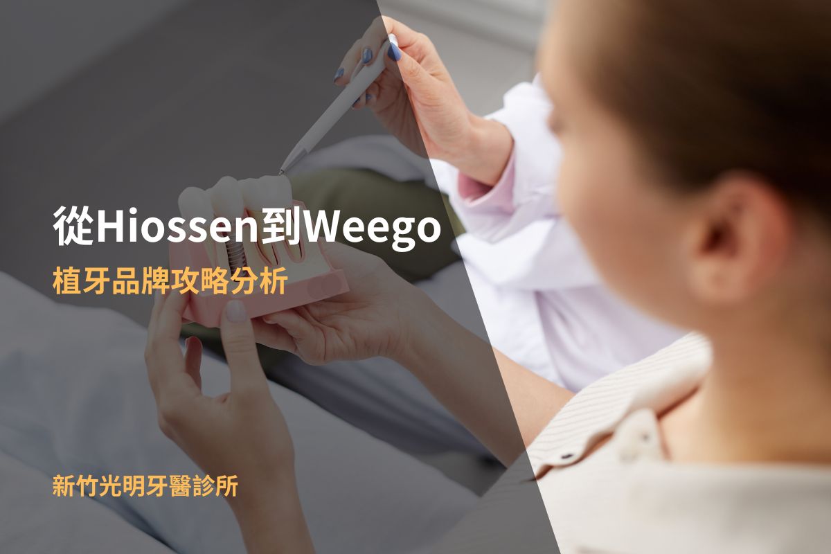 從Hiossen到Weego，植牙品牌攻略分析