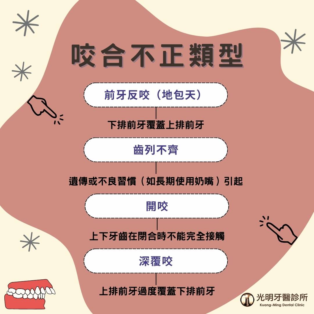 牙齒咬合不正的類型