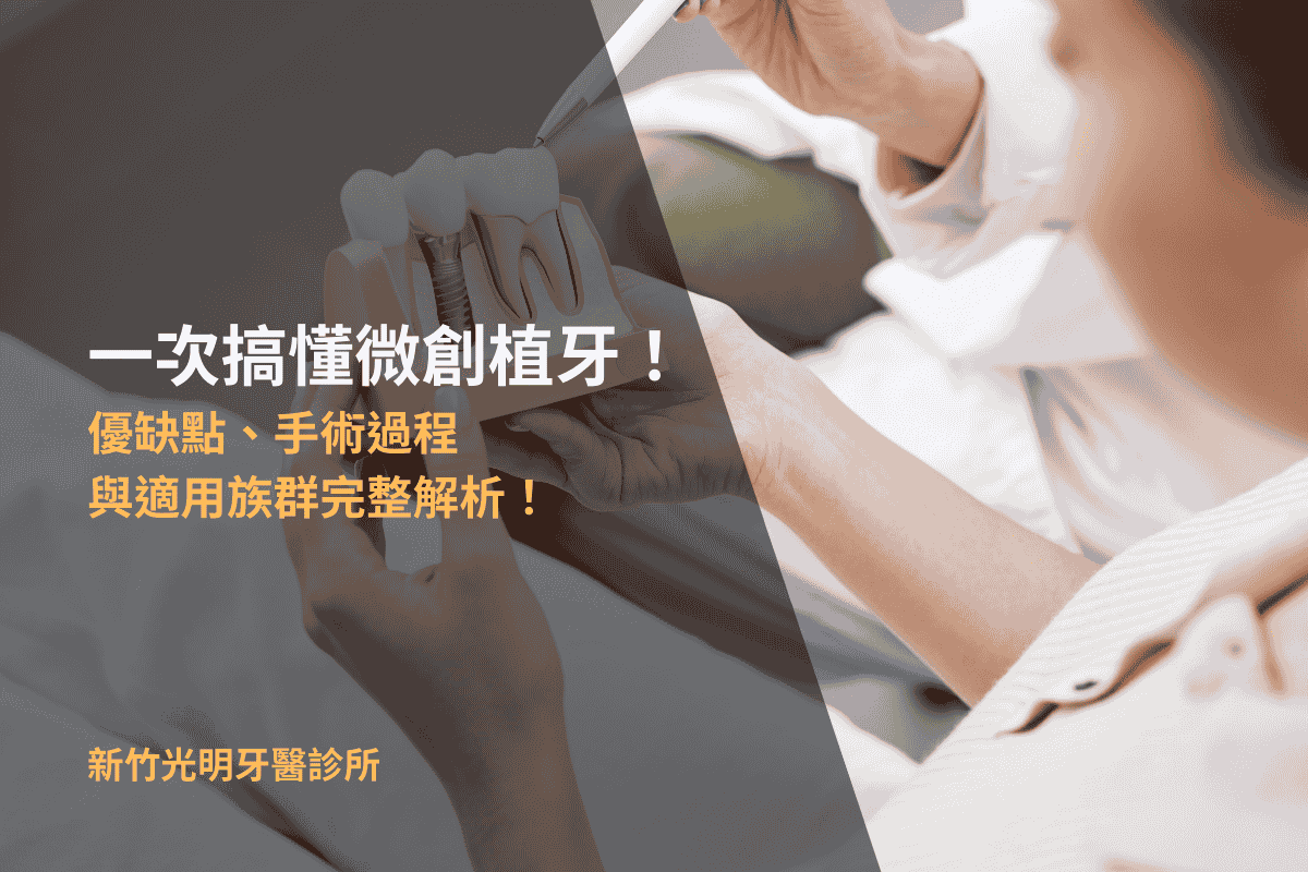 Read more about the article 一次搞懂微創植牙！優缺點、手術過程與適用族群完整解析！