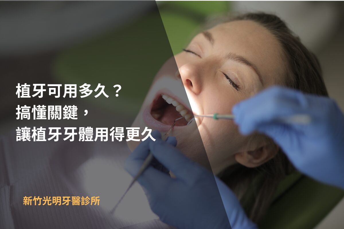 Read more about the article 植牙可用多久？搞懂關鍵，讓植牙牙體用得更久