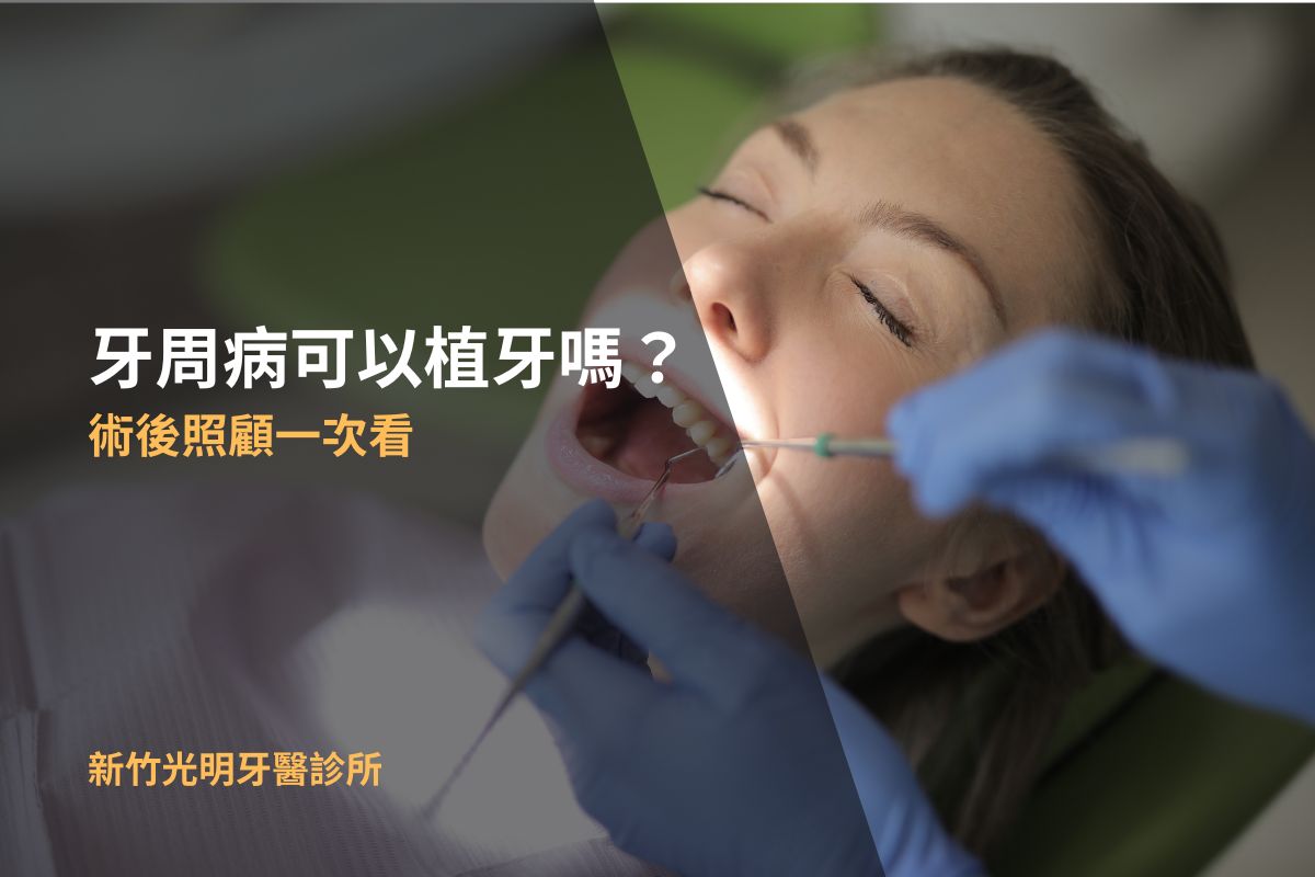 Read more about the article 牙周病可以植牙嗎？術後照顧一次看