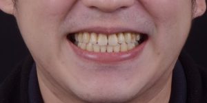 drbrian-ft-case1-small