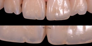 drbrian-ft-case14-small