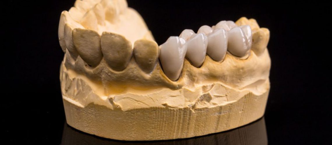 false-teeth-2021-08-26-17-52-13-utc (1)