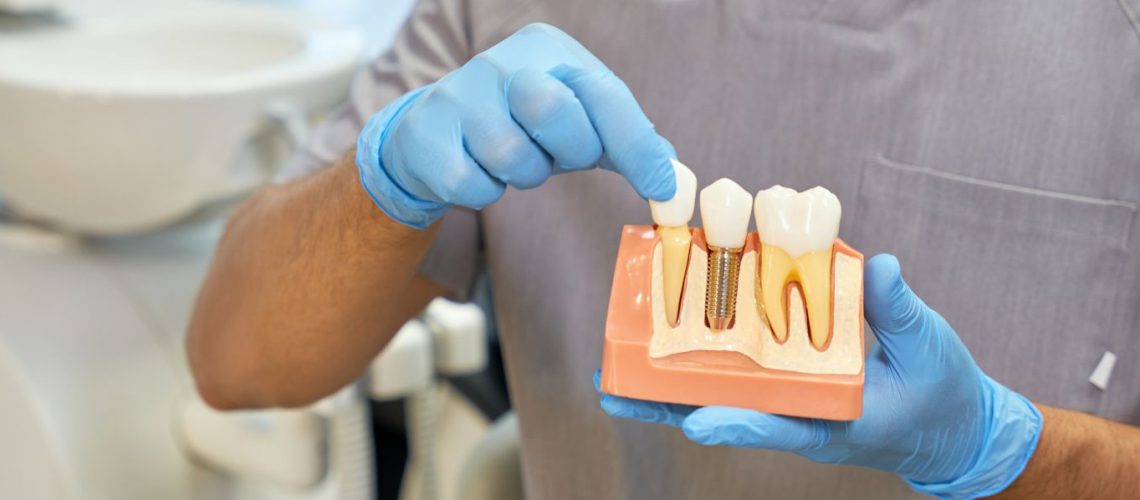 skillful-dental-technician-showing-anatomy-of-dent